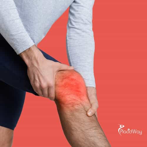 Knee Regeneration with Stem Cells in Thailand: A Practical Guide for Singaporean Patients